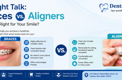Straight Talk: Braces vs. Aligners – Which is Right for Your Smile?