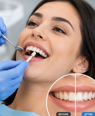 Cosmetic Dental Treatment