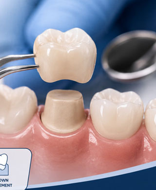 Crown & Bridge Treatment