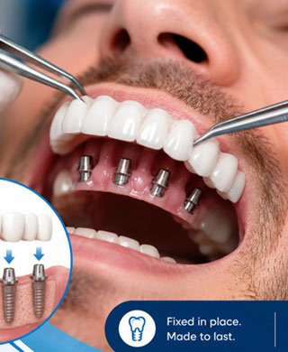 Fixed Dentures